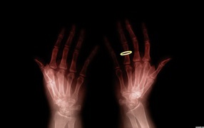 Просвечивать руки