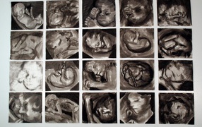 Картина Марлен Дюма - Плод