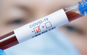 Анализ крови на коронавирус covid-19 положительный 