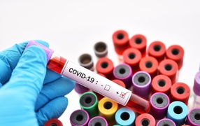 Пробирки с анализами на коронавирус covid-19, пандемия 