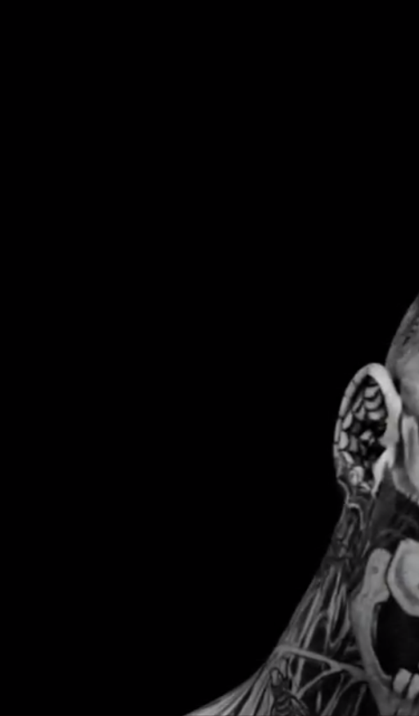 Суперзвезда Рик Жене