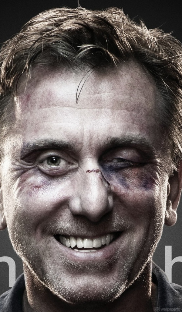 Актер с подбитым глазом