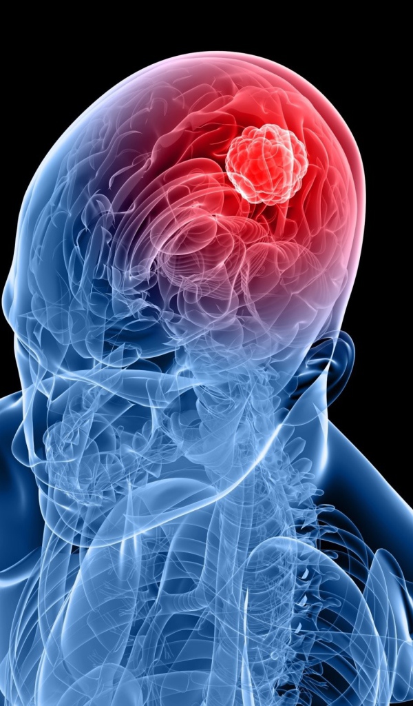 Очаг возбуждения в мозгу человека