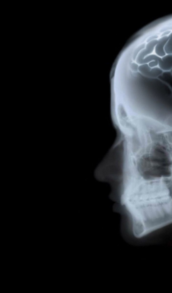 Знак ОС Fedora на рентгене