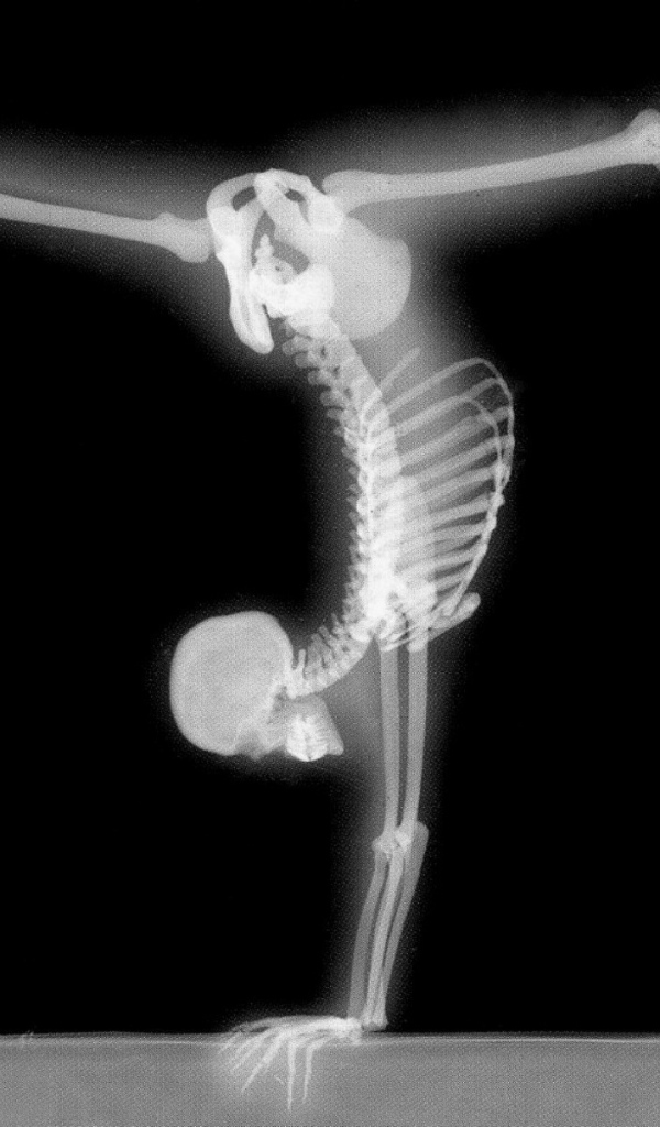 Рентген гимнаста