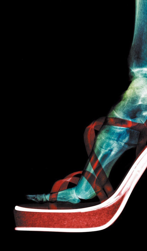 Рентген женской ноги