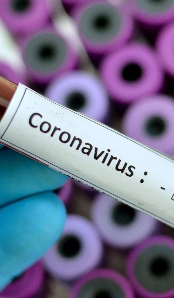Пробирка с анализом на коронавирус covid-19 в руке