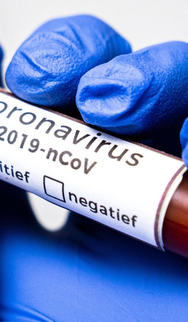 Положительный результат на коронавирус COVID-19