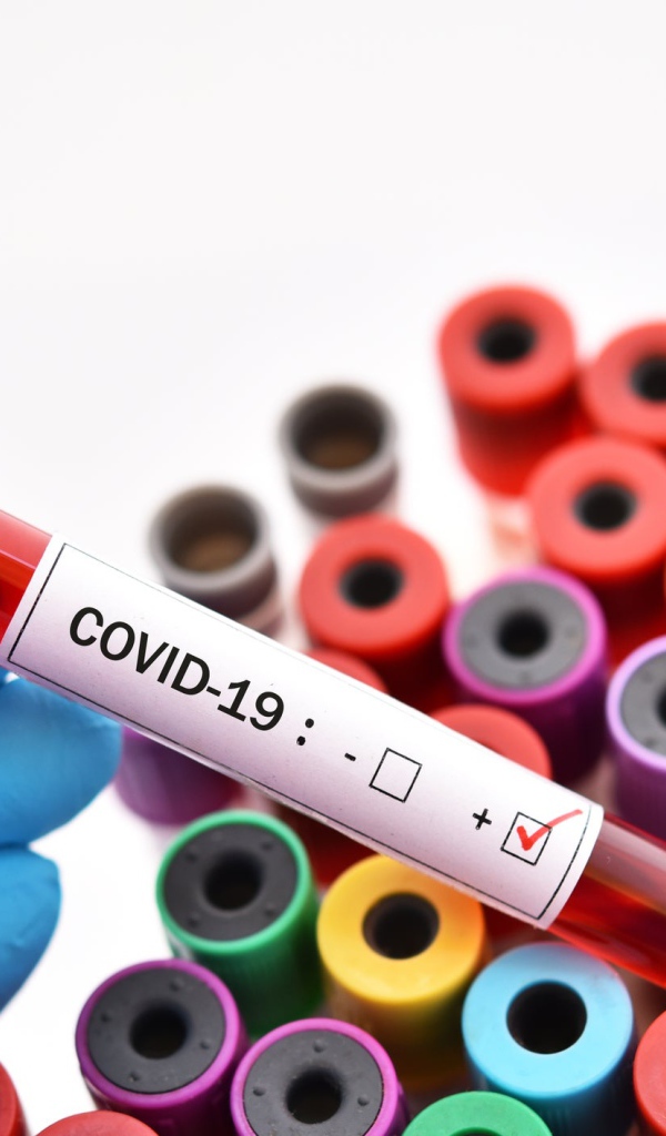 Пробирки с анализами на коронавирус covid-19, пандемия 