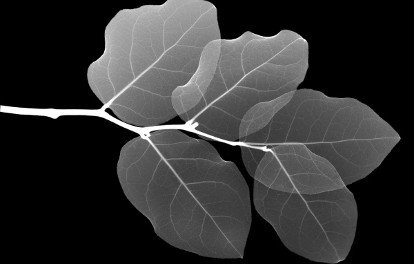 Рентген Листа