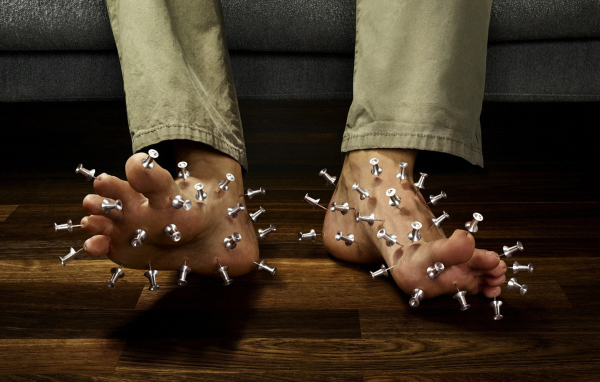 Иглотерапия