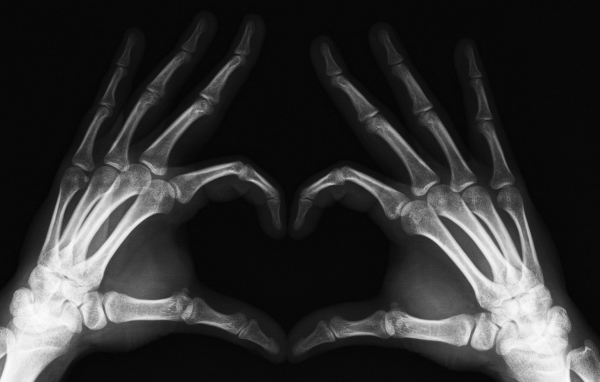 Сердце в рентгене