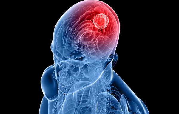 Очаг возбуждения в мозгу человека