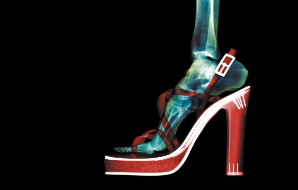 Рентген женской ноги