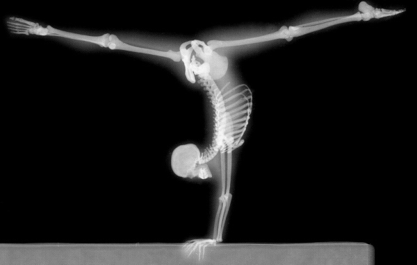 Рентген гимнаста