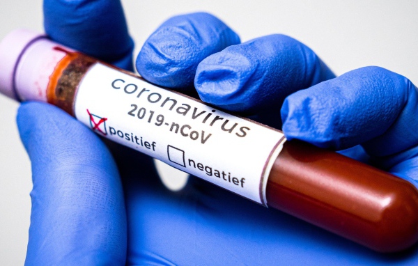 Положительный результат на коронавирус COVID-19