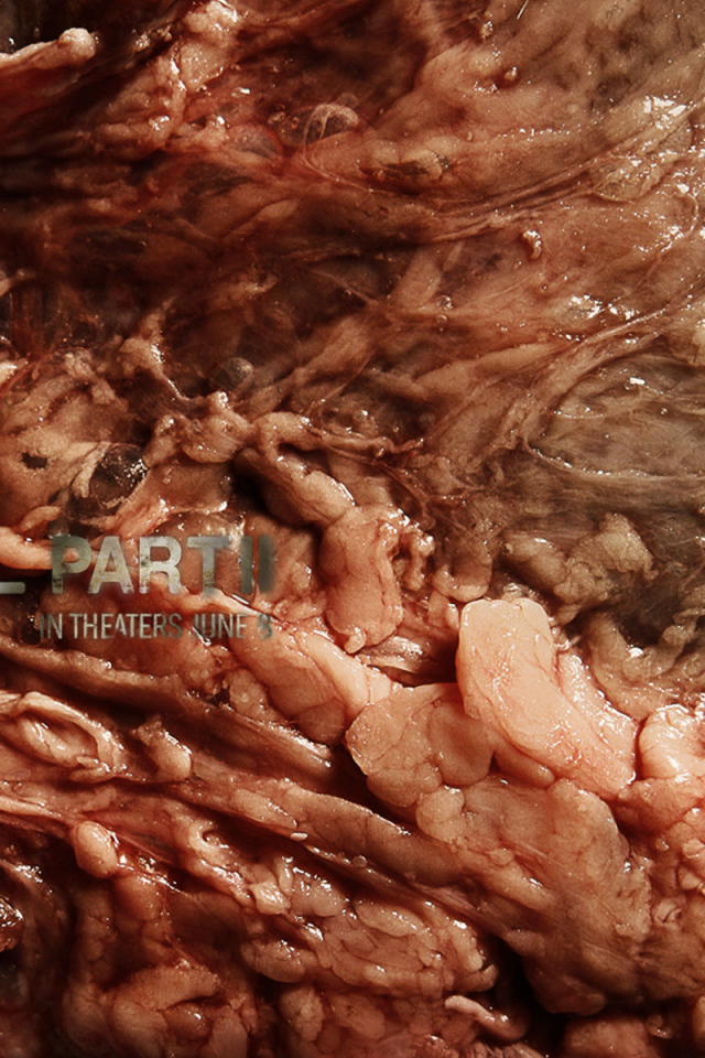 Хостел 2 / Hostel 2