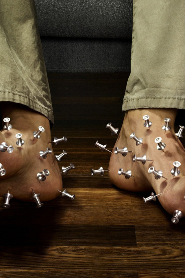 Иглотерапия