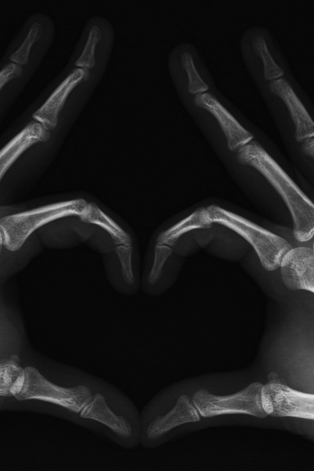 Сердце в рентгене