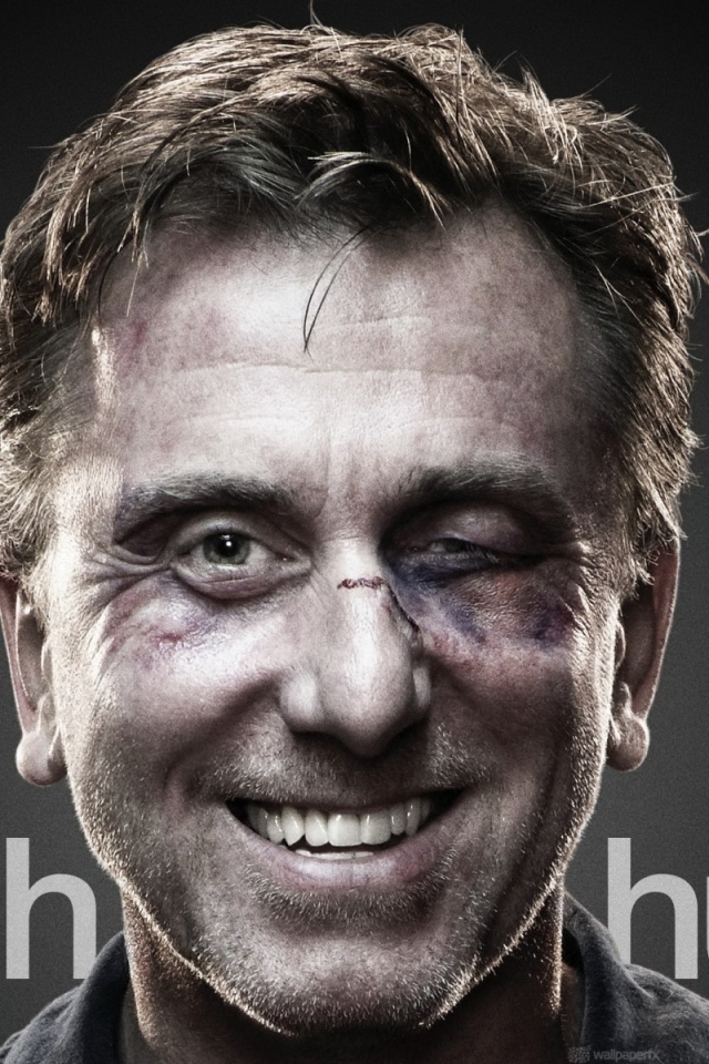 Актер с подбитым глазом