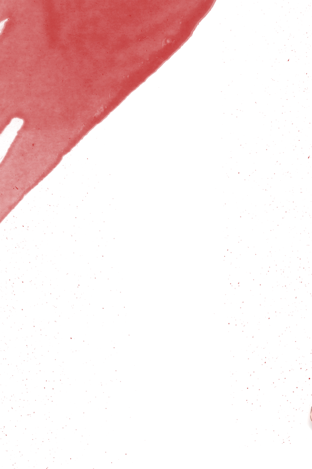 Девушка Мирая Никки с ножом, аниме