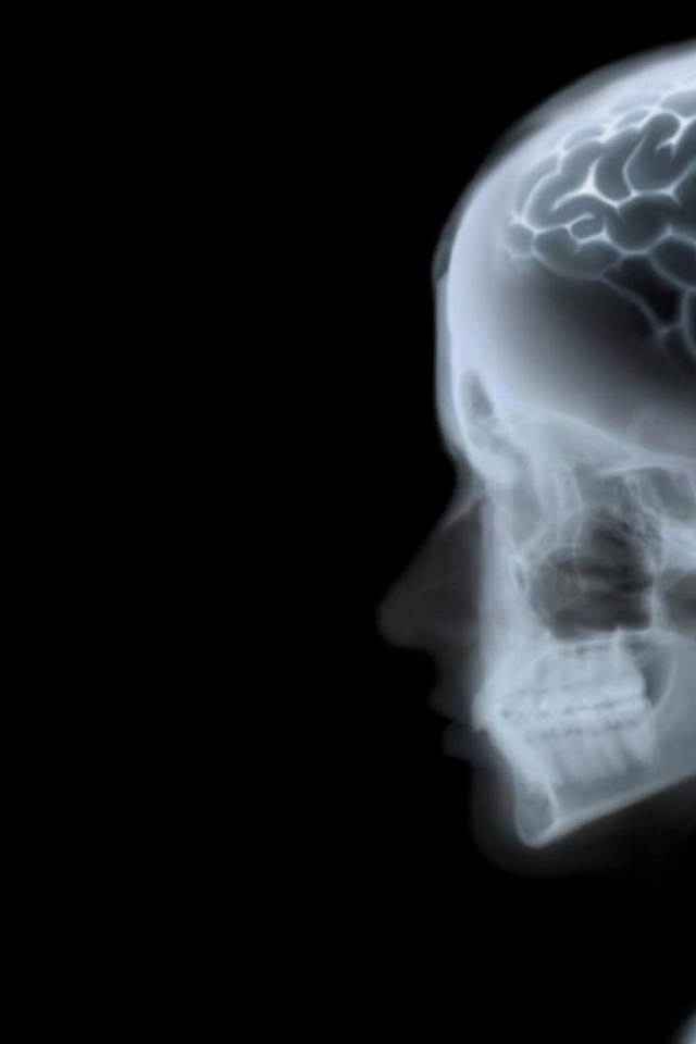 Знак ОС Fedora на рентгене