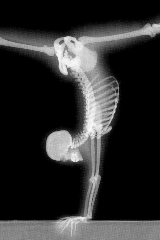 Рентген гимнаста