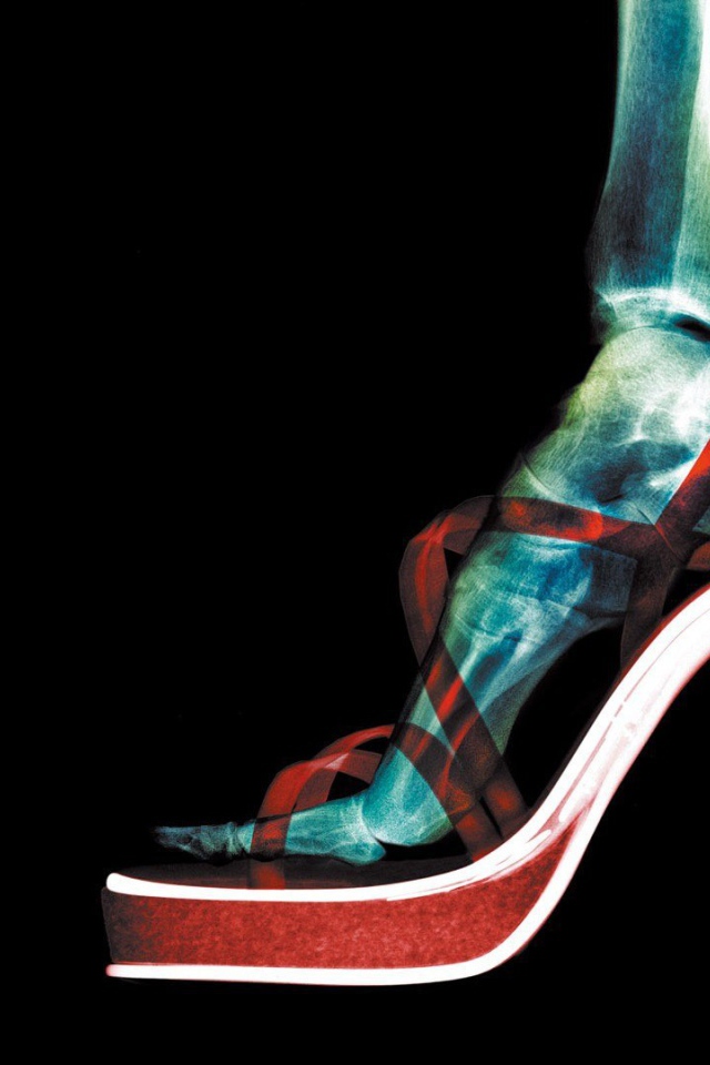 Рентген женской ноги