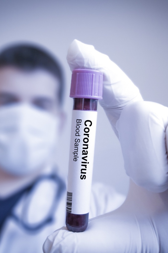 Анализ на коронавирус covid-19 в пробирке в руке