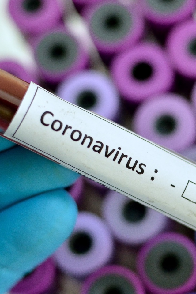 Пробирка с анализом на коронавирус covid-19 в руке