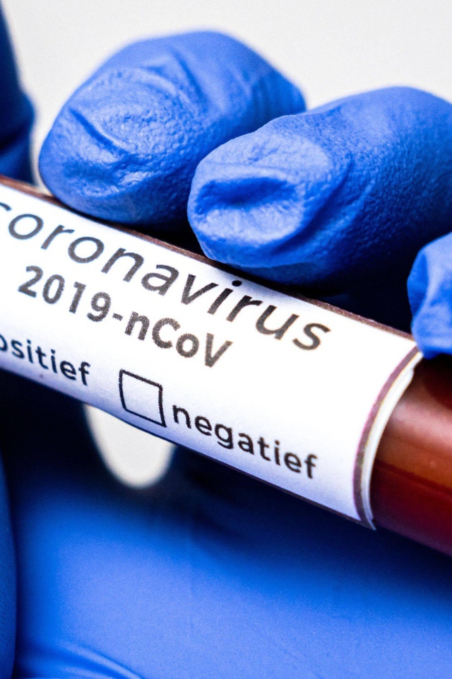 Положительный результат на коронавирус COVID-19