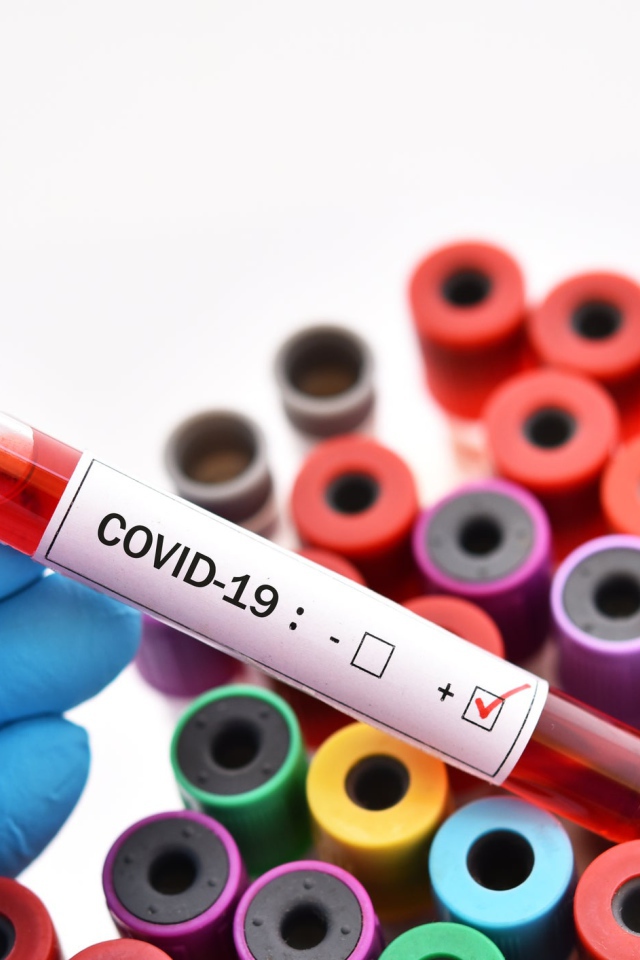 Пробирки с анализами на коронавирус covid-19, пандемия 